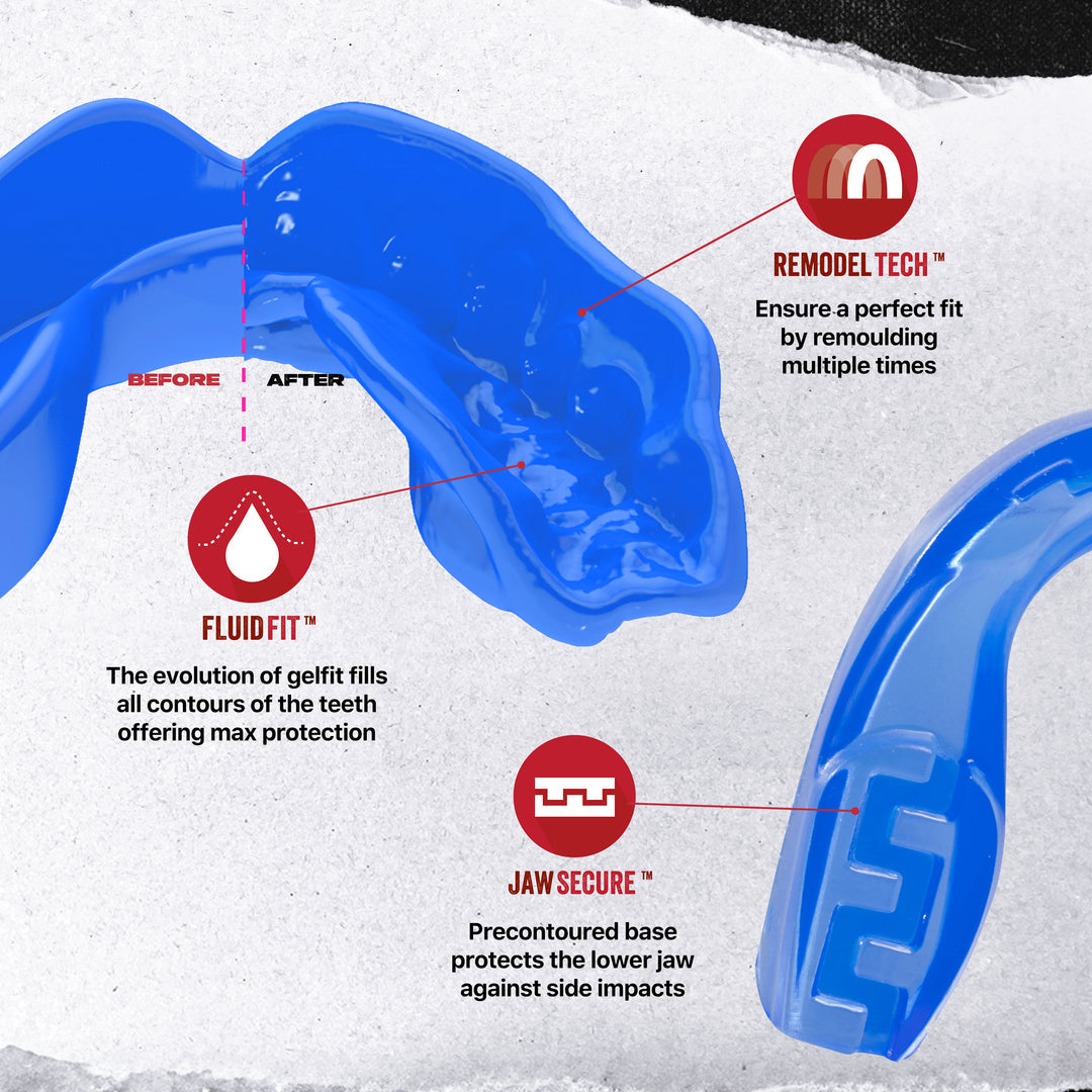 Safejawz - Extro Series "ICE" Gebitsbeschermer