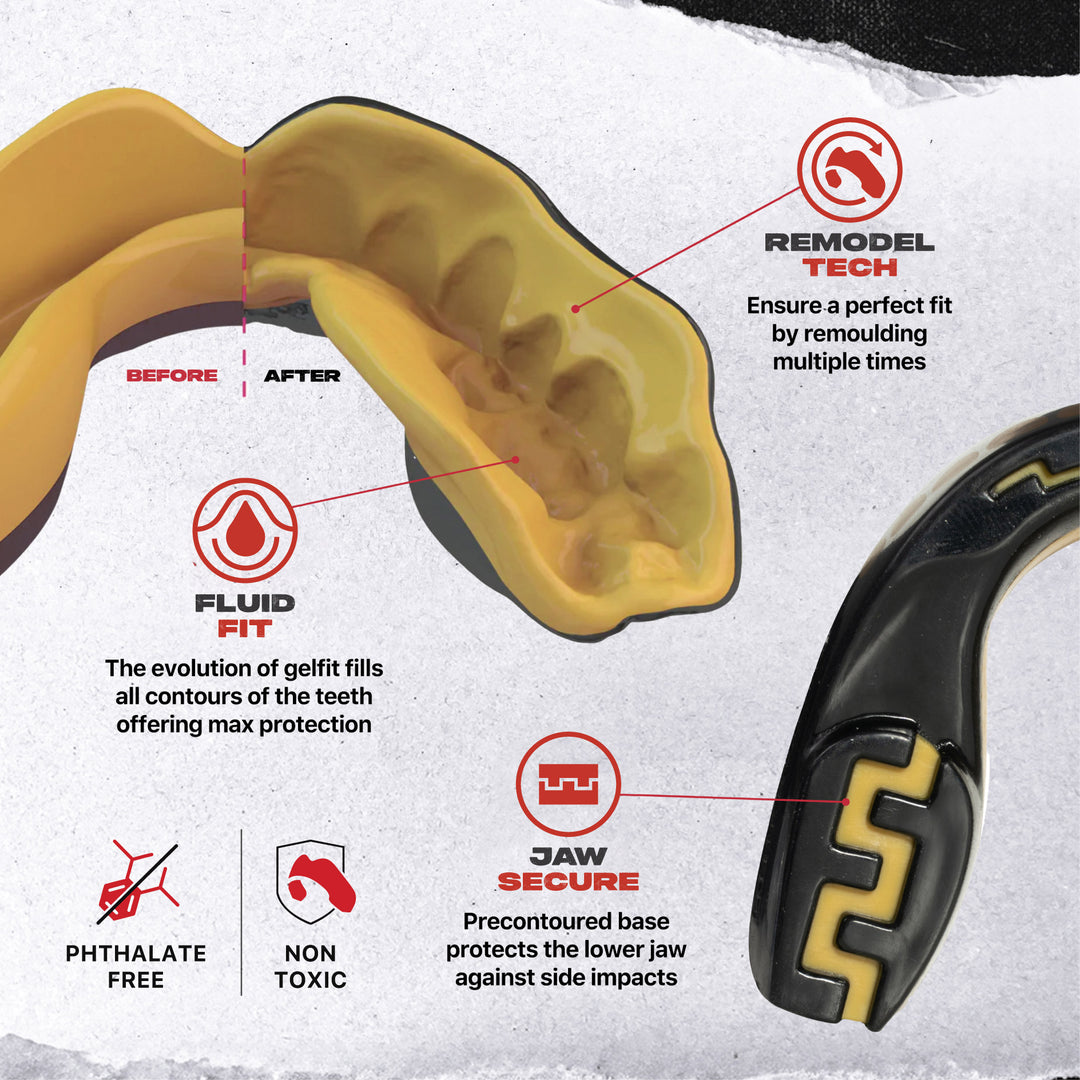 Safejawz - Extro Series "Gold & Black" Mouthguard