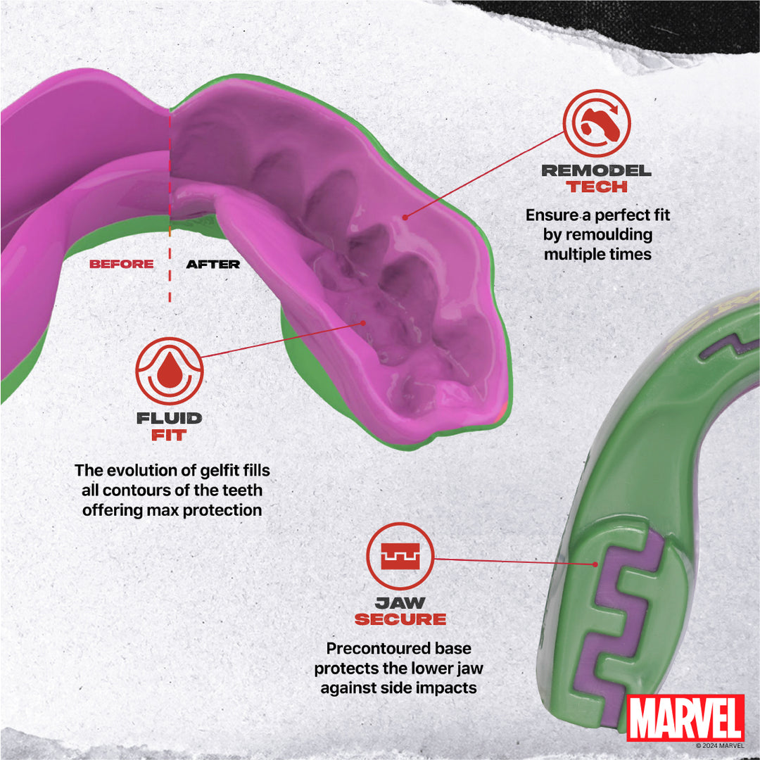 Safejawz - Marvel Hulk Mondbeschermer