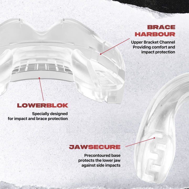 Safejawz - Ortho Series Mouthguard for Braces (Clear)
