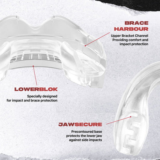 Safejawz - Ortho Series Mouthguard for Braces (Clear)