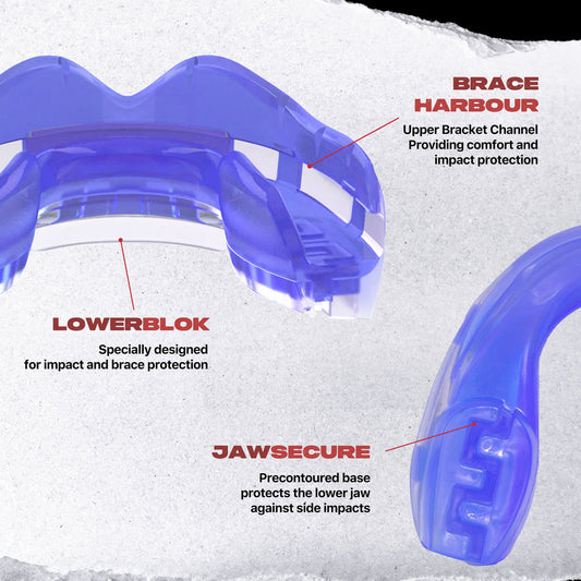Safejawz - Ortho Series Mouthguard for Braces (Blue)