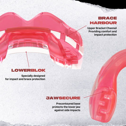 Safejawz - Ortho Series Mouthguard for Braces (Pink)